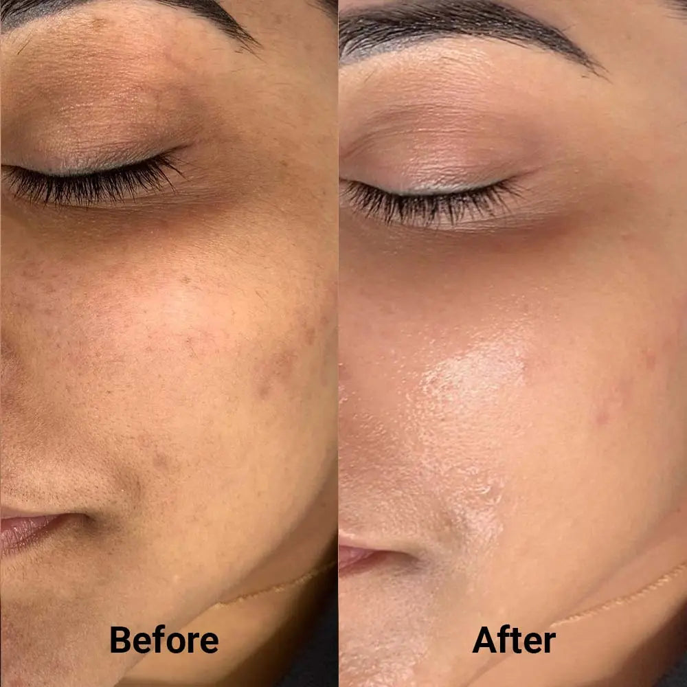 Sebum Balancing Cream Mskin Community